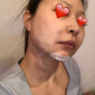 0日目の経過画像（3枚目）