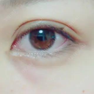 5日目の経過画像（2枚目）