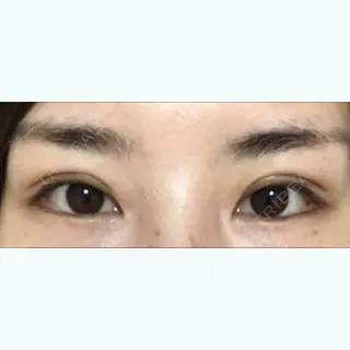 9日目の経過画像（1枚目）
