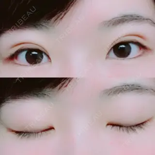 28日目の経過画像（1枚目）