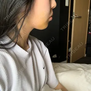 7日目の経過画像（2枚目）