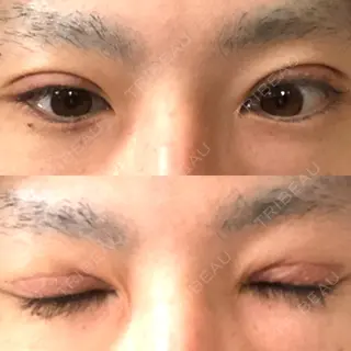 8日目の経過画像（1枚目）