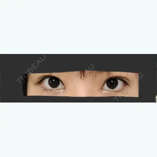 6日目の経過画像（1枚目）