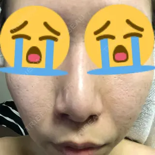23日目の経過画像（1枚目）