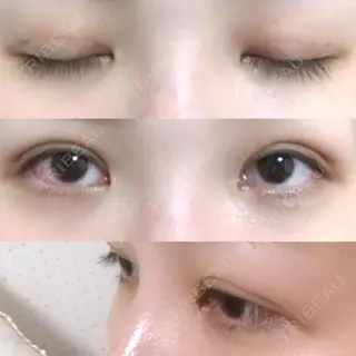 5日目の経過画像（1枚目）