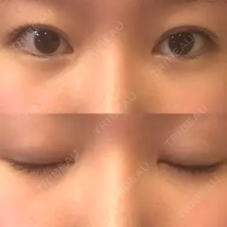 169日目の経過画像（1枚目）