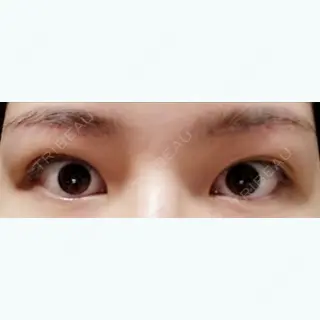 55日目の経過画像（1枚目）