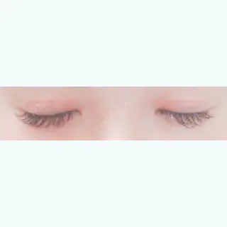 32日目の経過画像（2枚目）