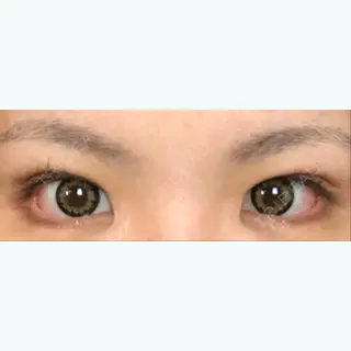 7日目の経過画像（3枚目）