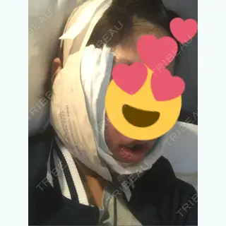 2日目の経過画像（3枚目）