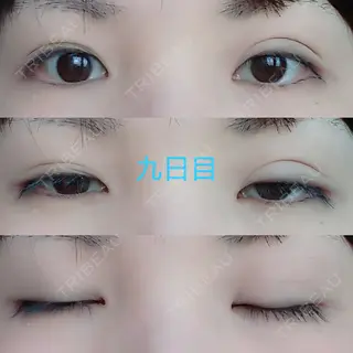9日目の経過画像（1枚目）