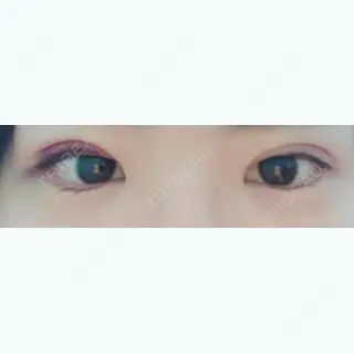 1日目の経過画像（1枚目）