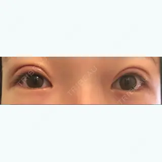 9日目の経過画像（1枚目）