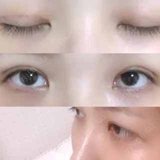 7日目の経過画像（1枚目）