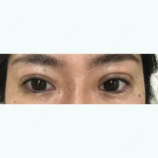 10日目の経過画像（1枚目）
