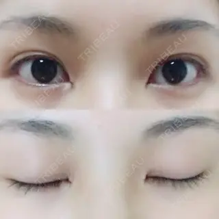 0日目の経過画像（1枚目）