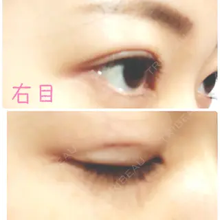 7日目の経過画像（2枚目）