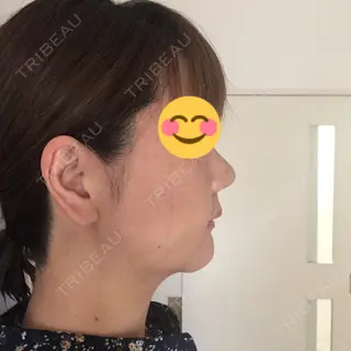 8日目の経過画像（3枚目）