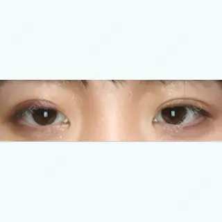 10日目の経過画像（1枚目）
