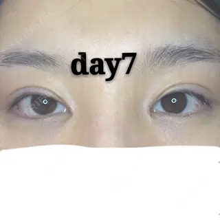 7日目の経過画像（1枚目）