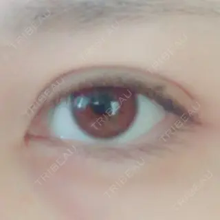 9日目の経過画像（2枚目）