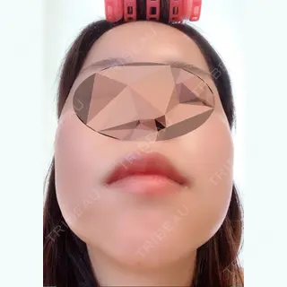 12日目の経過画像（2枚目）