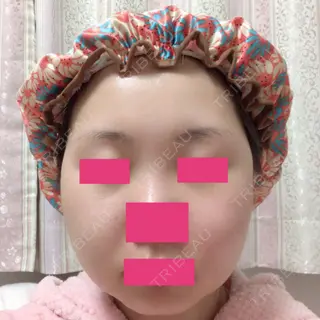 10日目の経過画像（1枚目）