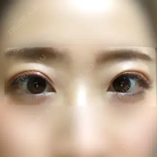 9日目の経過画像（1枚目）