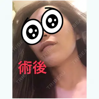 128日目の経過画像（2枚目）