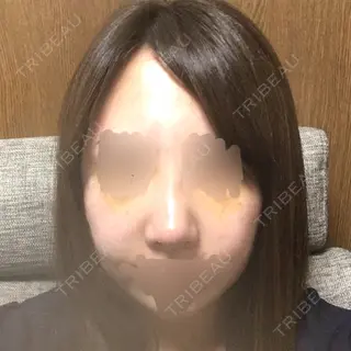 8日目の経過画像（2枚目）