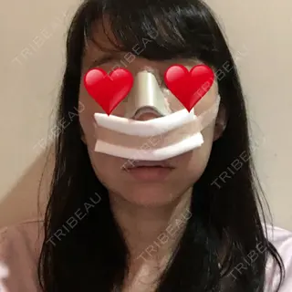 2日目の経過画像（1枚目）