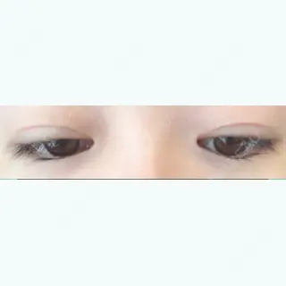 61日目の経過画像（2枚目）