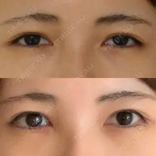 3日目の経過画像（1枚目）