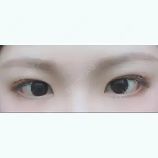 12日目の経過画像（1枚目）