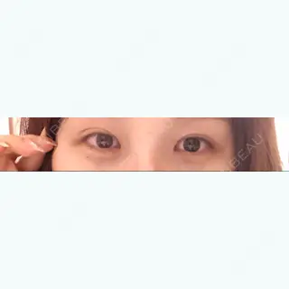 8日目の経過画像（2枚目）