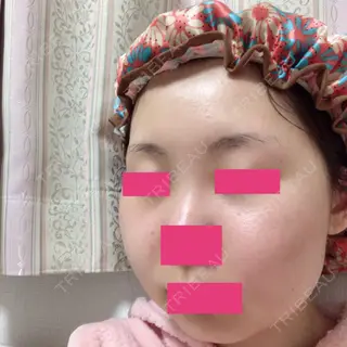 11日目の経過画像（2枚目）