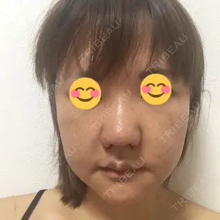 10日目の経過画像（1枚目）