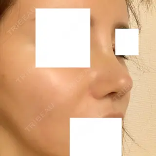 8日目の経過画像（2枚目）