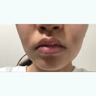 1日目の経過画像（3枚目）