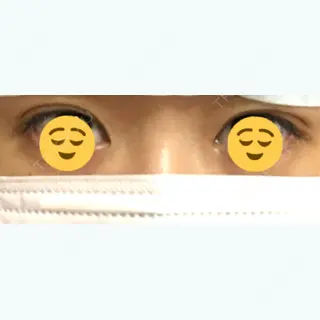 0日目の経過画像（2枚目）