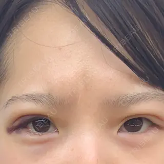 23日目の経過画像（1枚目）