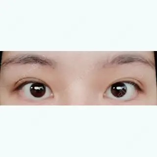 61日目の経過画像（1枚目）
