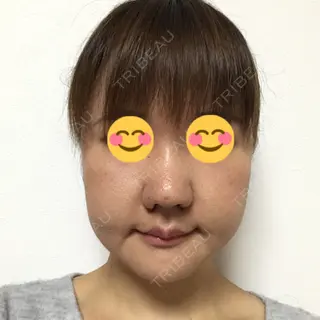 12日目の経過画像（1枚目）