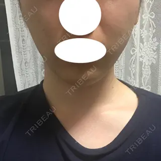 6日目の経過画像（1枚目）
