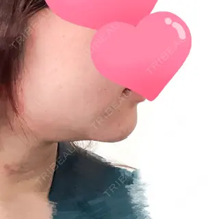 3日目の経過画像（3枚目）