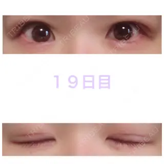19日目の経過画像（1枚目）