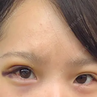 24日目の経過画像（1枚目）
