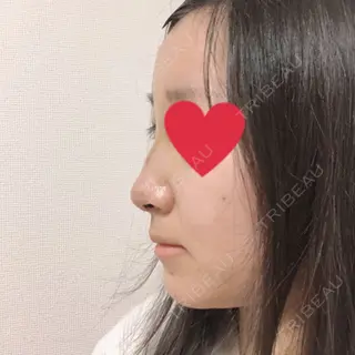 3日目の経過画像（3枚目）