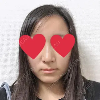 7日目の経過画像（1枚目）