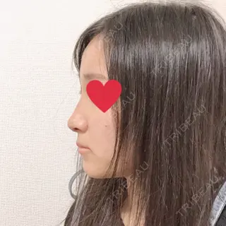 7日目の経過画像（2枚目）
